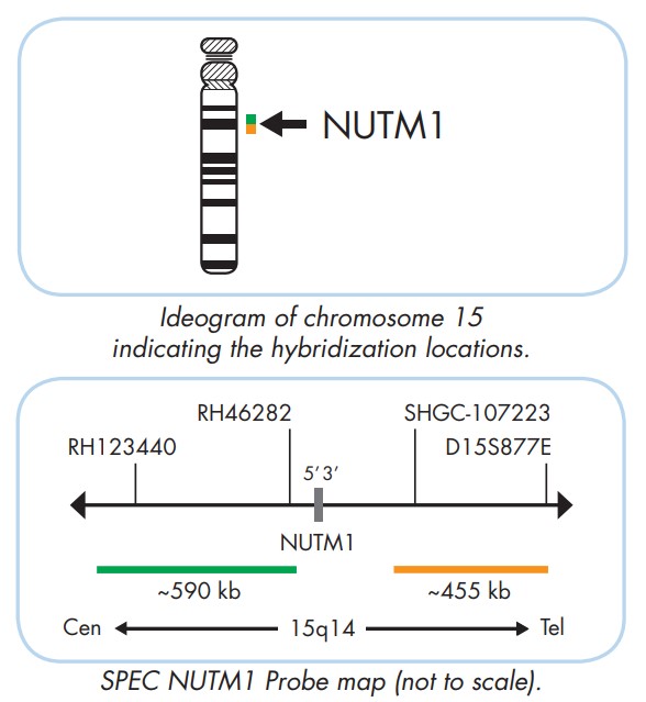 NUTM1 break apart